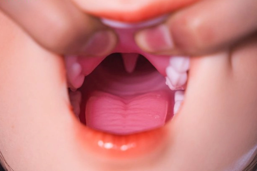 フェララブドールの口腔構造と内部テクスチャ解説図